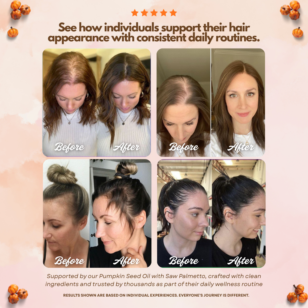 Collage of before and after style images showing different individuals with visible changes in hair appearance, density and styling, used to illustrate the intended hair formula benefits of PURETREX Pumpkin Seed Oil supplement over consistent use